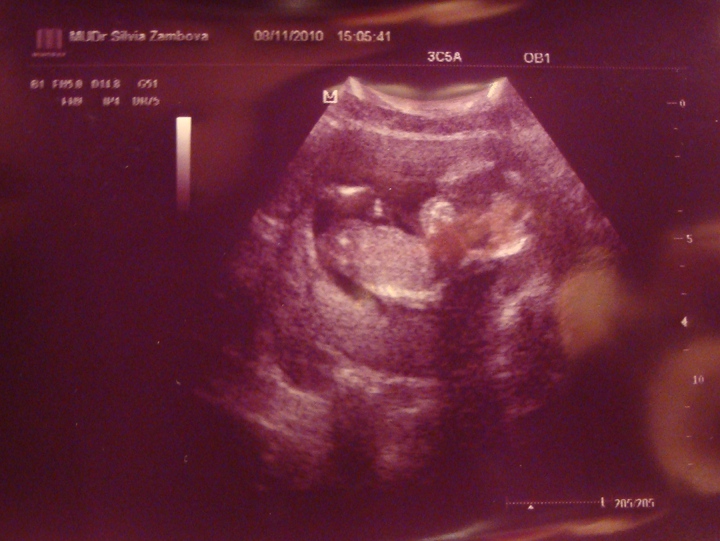 Our son, at 14 weeks post conception.